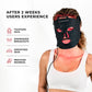 VISO Red Light Therapy Mask | FDA 510(k) Cleared