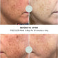 VISO Red Light Therapy Mask | FDA 510(k) Cleared