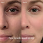 Solawave 4-in-1 Red Light Therapy Wand & Activating Serum Kit