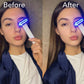 ZAQ Zayn 2.0 — 6-in-1 LED & Microcurrent Facial Wand